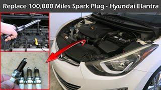 Replace 100,000 Miles Spark Plugs | NGK Iridium | Hyundai Elantra