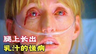 女人得了怪病，竟然醫生一時也沒招，結果腿上長出了乳汁！ 救援電影《腿上長怪病》。 短片，怪病，成精，解說，搞笑，動畫，動作，喜劇，獵奇，奇幻，腦洞，電影，科幻，超能力，short film