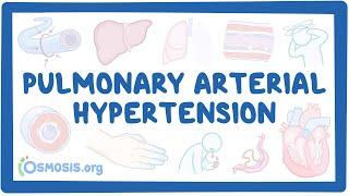 NORD - Pulmonary Arterial Hypertension