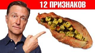 12 симптомов того, что желчный пузырь в опасности!