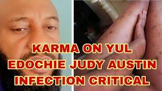 KARMA ON YUL EDOCHIE JUDY AUSTIN INFECTION CRITICAL