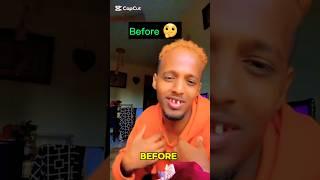 BEFORE & AFTER MAHREZ X ALPHA X ASAD HAGIO IYO CUMEER BIGFAN️️