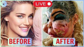 LIVE Famous Celebrities Unrecognizable After Plastic Surgery Gone Wrong | Then and Now 2025