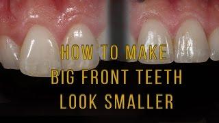 What to do if one tooth looks big and long