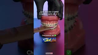 ¿Que comer con brackets en  ? - Odontología Láser #Shorts