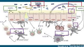 5/17/2019 It's a Gut Feeling: The Microbiome in Inflammatory Disease