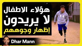 Dhar Mann Studios | الأطفال لا يريدون إظهار وجوههم