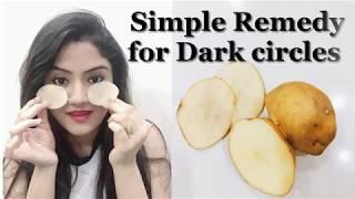 100% Natural and Effective home remedy for dark circles | In Hindi