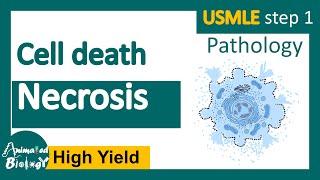 Necrosis and its subtypes | Necrosis - Cell Injury - General Pathology | USMLE step 1