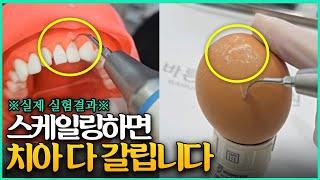 치과의사가 절대 말하지 않는 스케일링의 진실