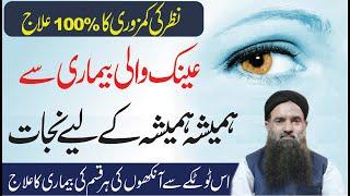 Nazar Ki Kamzori Ka ilaj - EyeSight Weak Treatment  By Dr Sharafat Ali - Health Care Hospital