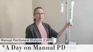 Peritoneal Dialysis (PD): What a day looks like doing Manual Exchanges in 2023