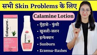 Calapure Calamine Lotion uses , benefits, how to use, side effects