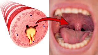 THIS is how you can get rid of mucus in your throat in just two minutes  (Surprisingly easy) 