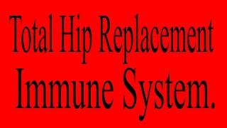 Pre Total Hip Replacement - Immune System.