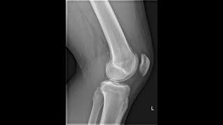 RADS.130 Anatomy of The Lower Leg, Knee and Femur