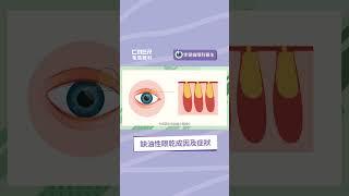 【缺油性眼乾成因及症狀】香港希瑪眼科中心 | 眼科Q&A | 李德倫眼科專科醫生
