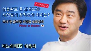 임플란트후의 강직도와 자연발기 강직도의 차이는? (국내 첫 ‘Made In Korea!’ 굴곡형 보형물 실물공개)