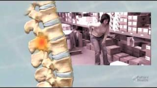 Treatment of Lower Back Pain by Future Health Software