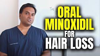 Oral Minoxidil For Hair Loss