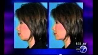 Virtual Plastic Surgery on ABC NEWS Chicago - 9.15.06 | Dr. Steven Dayan