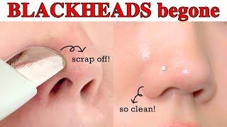 How do I manage my nose so smooth and clean? So SIMPLE Blackhead care 