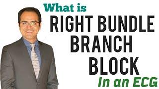 Right Bundle Branch Block (RBBB) ECG Interpretation Explained, How to identify RBBB Block,USMLE NEET