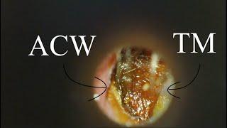 DEEP IMPACTION : ANTERIOR SULCUS : 4K/HD