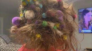 6-Year-Old Gets 150 Bunchems Velcro Balls Stuck in Her Hair