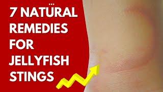 7 Natural Remedies For Jellyfish Sting