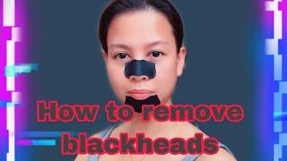 How to remove blackheads