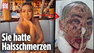 Thailändisches Influencer-Model durch Medikament entstellt