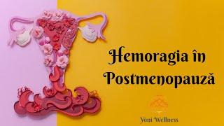 S2. Ep 75 - Hemoragia în postmenopauză | NU EXISTĂ ÎNTOARCEREA MENSTRUAȚIEI !!! | Riscul de cancer