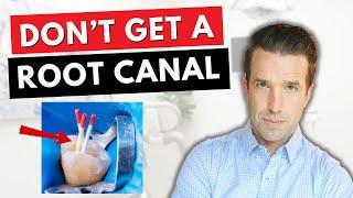 Don't get a ROOT CANAL before watching this!