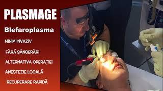 Blefaroplastie cu  PLASMAGE  - Blepharoplasma®  - Dr. Ciprian Fluras