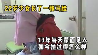 22岁少女长了一张马脸，13年每天蒙面见人，如今她过得怎么样？