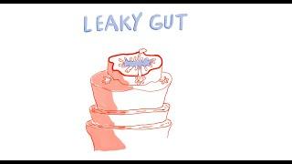 What is Leaky Gut and How to Manage It?