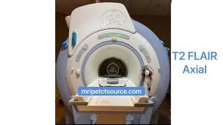 Specialized Brain MRI Scan Sounds Inside Scan for Brain Shunt