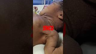 Sncu Special Neonate Care Unit.