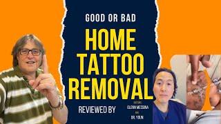 Home tattoo Removal Using Salt  Reviewed by Dr. Messina & Dr. Youn, Is It Safe?