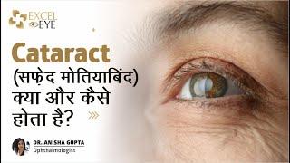 Cataract (सफ़ेद मोतियाबिंद) क्या और कैसे होता है? Dr Anisha Gupta - Eye Specialist in Delhi,Excel Eye