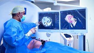 Tumor Ablation with CAS-One IR | Full Procedure