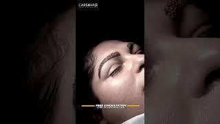 Eyebrow Transplant: This is the procedure that gives natural density to your eyebrows  | Care4Hair