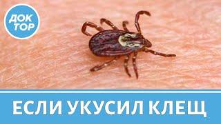 Что делать, если укусил клещ? Первая помощь