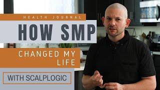 How SMP Changed My Life- Health Journal | Scalp Micro pigmentation Review |