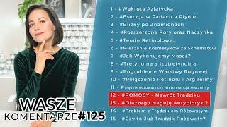 NAWRÓT TRĄDZIKU | TEORIE RETINOLOWE | DLACZEGO NEGUJĘ ANTYBIOTYKOTERAPIĘ | CZY TO JUŻ TRĄDZIK WK#125