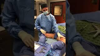 Thigh Lift (Thighplasty) with Dr. Michael Rossi