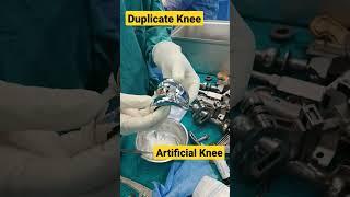 Total Knee Replacement  | #totalkneereplacementsurgery #kneereplacementoperation #kneearthritis