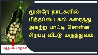 பித்தப்பை கல்லை கரைத்து வெளியேற்ற பாட்டி வைத்தியம் | Gallbladder home remedy cleansing.