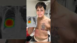 Hina Khan Breast Scan after Surgery